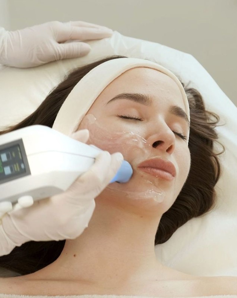 Woman receiving a professional facial ultrasound treatment with gel and headband, clinician using a handheld device