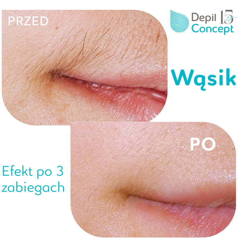 Obrazek